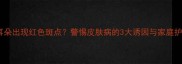 金毛犬耳朵出现红色斑点警惕皮肤病的3大诱因与家庭护理指南