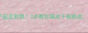 拉布拉多鼻子起皮别慌3步教你搞定干裂脱皮附护理全攻略