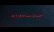泰迪皮肤病会不会传染