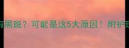 猫咪鼻子有黑斑可能是这5大原因附护理指南