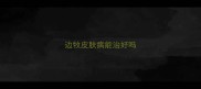 边牧皮肤病能治好吗