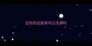 边牧的皮肤病可以洗澡吗